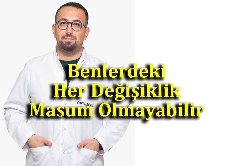 Çok Sayıda Beni Olan Kişiler Dikkatli Olmalı